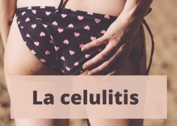 La celulitis
