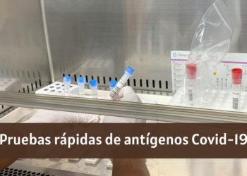 Los Hospitales Quirónsalud de Andalucía incorporan las pruebas rápidas de antígenos Covid-19