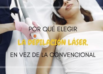 Depilación láser