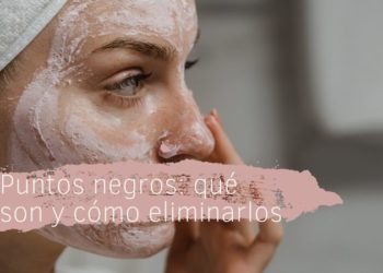 Puntos negros: qué son y cómo eliminarlos