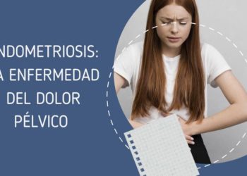 Endometriosis: la enfermedad del dolor pélvico