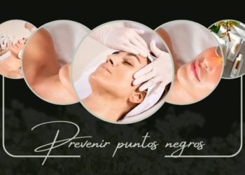 Cómo eliminar y prevenir puntos negros: Consejos para una piel saludable