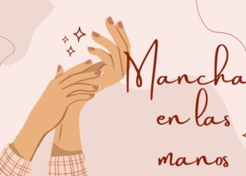 Manchas en las manos