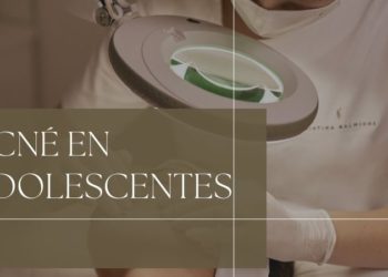 El poderoso mensaje del influencer malagueño Javier Esdo para concienciar sobre el acné en los adolescentes